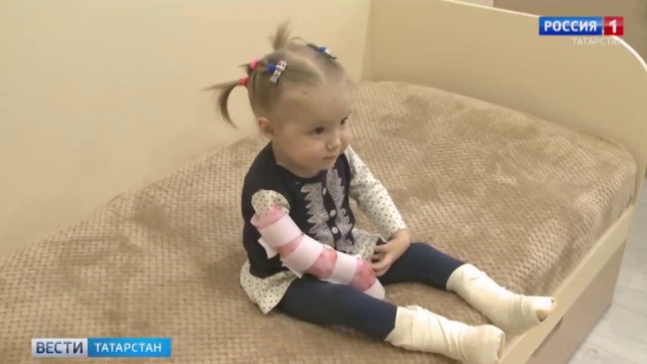 Малика Хасанова, 2 года, артрогрипоз, тетраформа, деформация стоп - YouTube