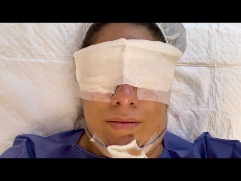 عمل ساكشن غبغب ولاگ بدون سانسور تجربه من از جراحي ليپو هيشكي نگفته بود انقدر سخته