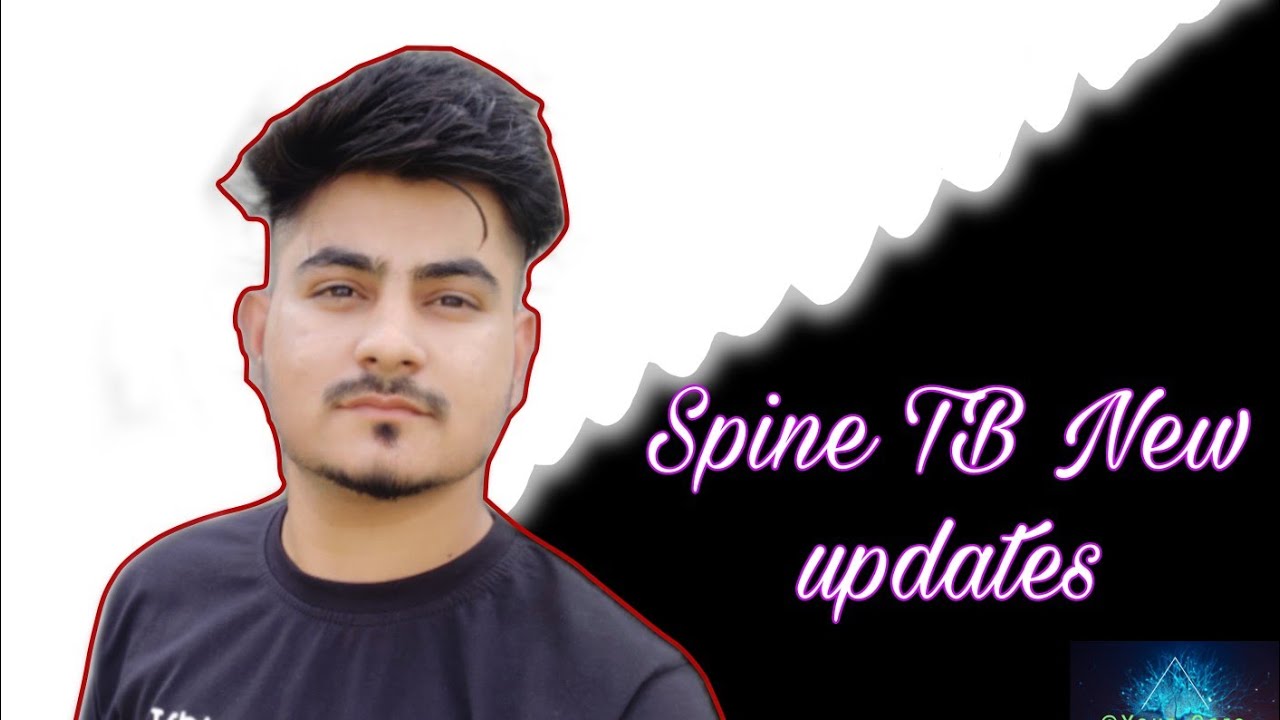 Spine TB New updatestb ki bimari kaise hoti haiSpine TB treatment in