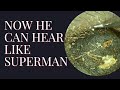 Now He Can Hear Like Superman !