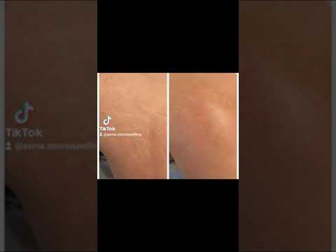 YouTube player