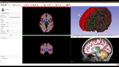 Import FreeSurfer subjects into 3D Slicer