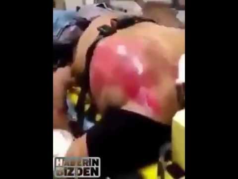 رجل يشرب 20 علبة ريد بول في وقت واحد