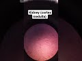 kidney cortex medulla labeled histology slides microscopic structure