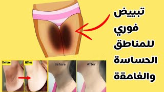 تبييض فوري للمناطق الحساسة والغامقة | تقشير + دهان سحري بمكونات بسيطة