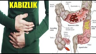 Tuvalete gidememe sorunu nasıl giderilir?Kabızlık!DEZ
