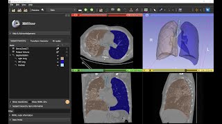 COVID-19 lung CT segmentation using 3D Slicer screenshot 4