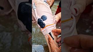 Teteh Di Gigit Lintah