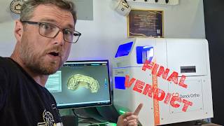 I Was Asking the Wrong Question... | My DenckOrtho Review