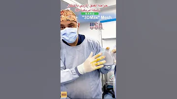 شبكة 3D مخصصة لجراحة الفتق الاربي بالمنظار 