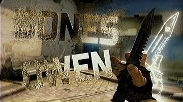 BONES - Owen (CS:GO)