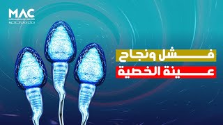 مركز مصر للذكورة | اسباب فشل ونجاح عينة الخصية