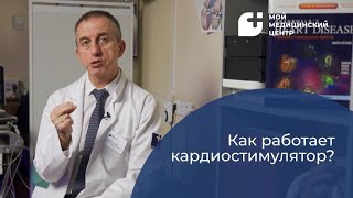 Как работает кардиостимулятор?