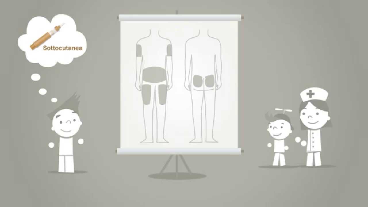 I diversi tipi di iniezione | Guide Pic it easy!