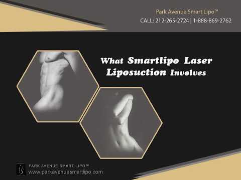 New liposuction technologies: How smart is Smart lipo? - Cosmeticsurg