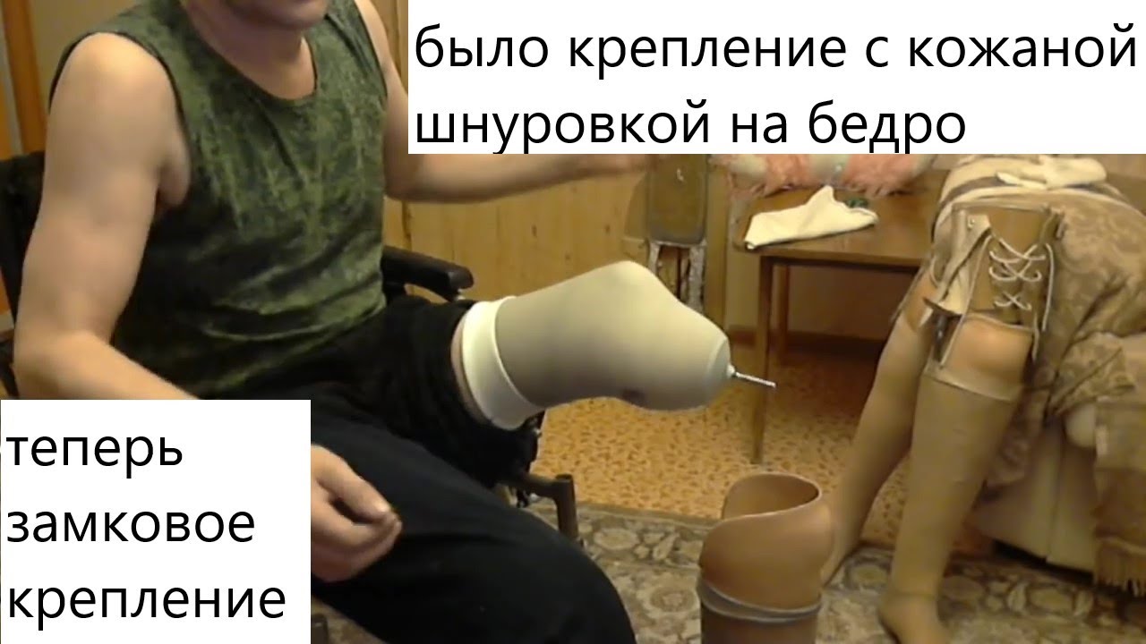 Протез голени. Почему я выбираю протез с силиконовым чехлом?