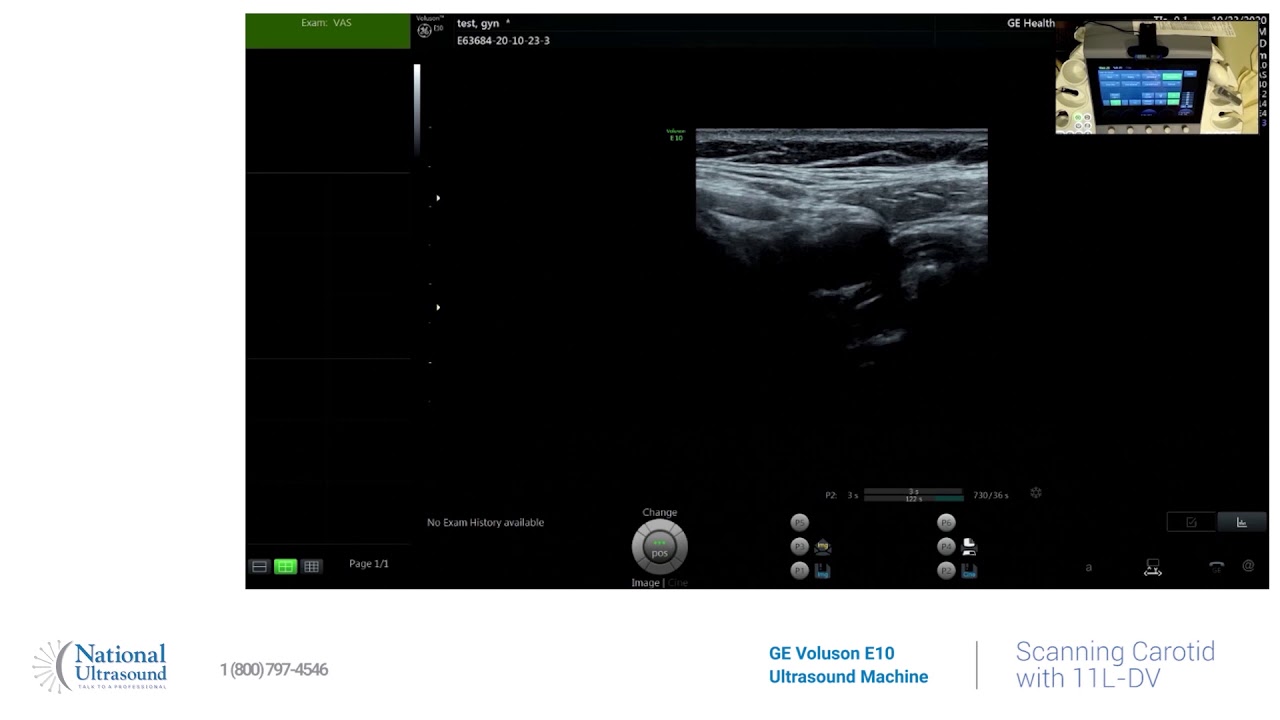 GE Voluson E10 Scanning Carotid Artery Training Video