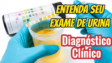Qual o resultado normal do exame de urina?