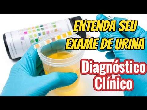 Vídeo: Quais métodos são usados para quantificar as cetonas na urina?