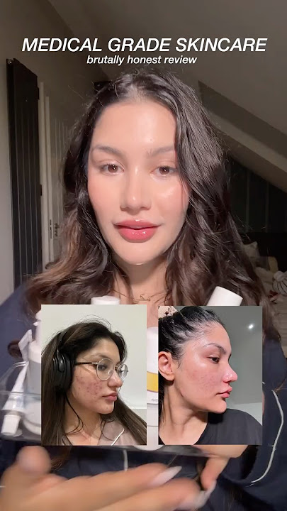 Obagi Medical Grade Skincare Review! #acne #skincare #skincaretips #obagi #zoskinhealth #zoskincare