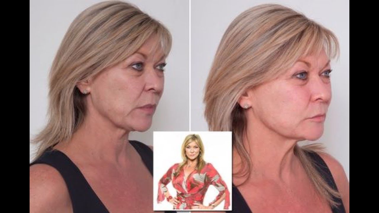 Emmerdale's Claire King reveals why she is never having ...