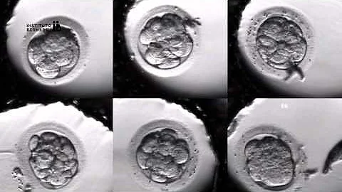 IVF PROCESS STEP BY STEP (In Vitro Fertilisation): Embryo cultivation - DayDayNews