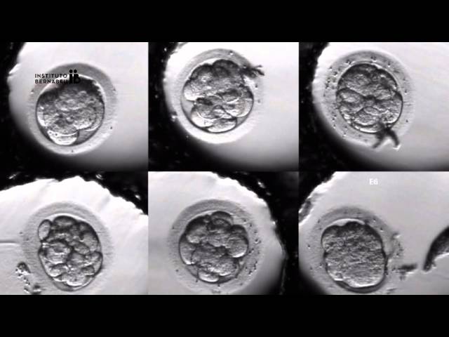 IVF PROCESS STEP BY STEP (In Vitro Fertilisation): Embryo cultivation class=
