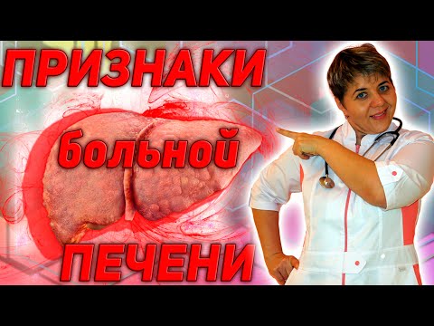 💊 Признаки, что ваша 🔴 ПЕЧЕНЬ НЕЗДОРОВА 🔥