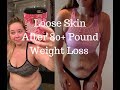 Loose Skin - Showing My Worst - My Biggest Insecurity After Losing 80+ Pounds