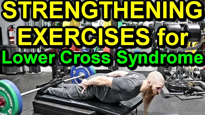 HOW TO CORRECT LOWER CROSS SYNDROME: Top 5 Strengthening Exercises for Posture Correction