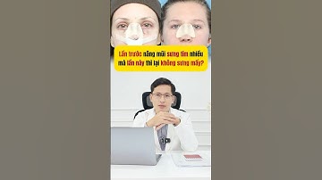 Tại sao nâng mũi lần sau không sưng như lần đầu #bsdinhduongthammy #bs_đình_dương #lamdep