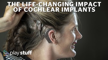 Cochlear implants: The life-changing impact of hearing technology | Stuff.co.nz
