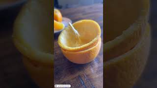 The Incredible Organ Of Form...fascia