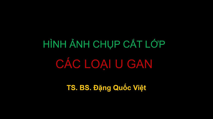 Chụp cắt lớp gan giá bao nhiêu năm 2024