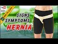 10 Signs and Symptoms of a Hernia