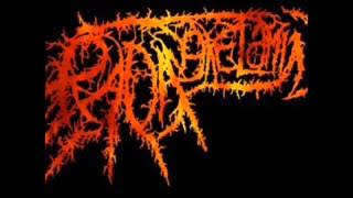 Download lagu Radang Kelamin Katakan Tidak Pada Toket Tepos