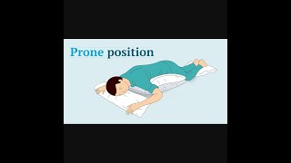 Awake proning in hospitalized patients with COVID-19 (September 2021)