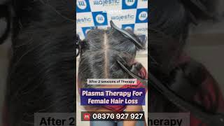 Effective Plasma Therapy For Female Hair Loss Painless 08376927927