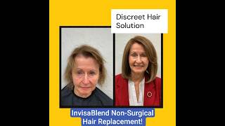 The Future of Hair Replacement Is Here| Upgrade From Wigs & Heavy Toppers | InvisaBlend Non‑Surgical