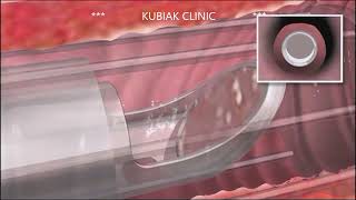 Antoni Kubiak-19