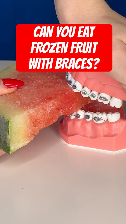 Can you eat FROZEN FRUIT with BRACES? ASMR #braces #watermelon #fruit