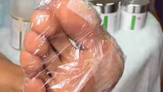 Педикюр на фруктовых кислотах Педикюр на фруктовых кислотах