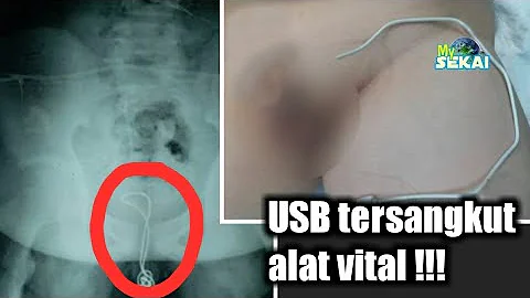 Wanita Di Bangladesh Yang Dimasukin Botol Di Kelamin