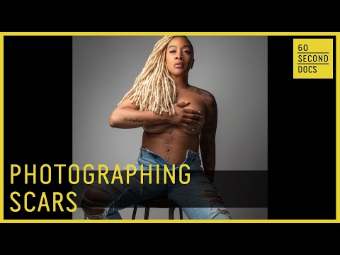 Why Alkan Emin Photographs Scars