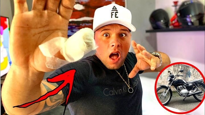 SOFRI UM GRAVE ACIDENTE COM MINHA MOTO * NÃO É CLICKBAIT *