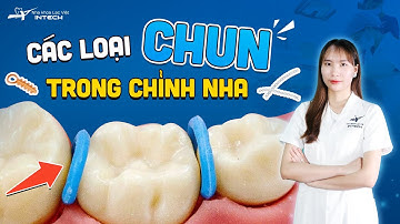 Các Loại Chun Chỉnh Nha | Tính Năng, Ưu Điểm Và Cách Trường Hợp Dùng Chun Niềng Răng Khác Nhau