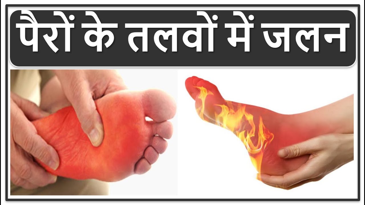 पैरों के तलवों में जलन का इलाज, पैरों में जलन होने से कौन सी बीमारी