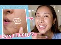 When nothing else works... 3 Easy *SOS* Steps for ALL Skin Types!