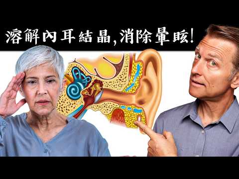 頭暈眩,耳朵內結晶,第一名缺維生素,自然療法,柏格醫生 Dr Berg