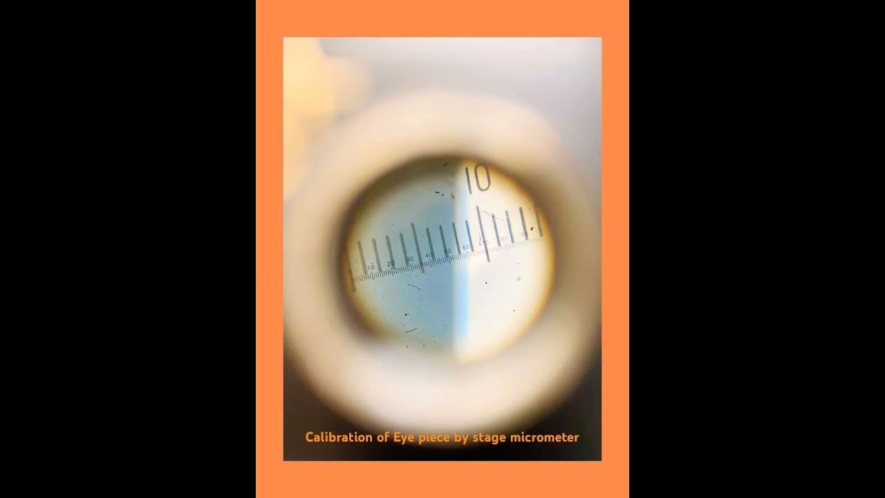 Calibration of Eye piece micrometer by stage micrometer.